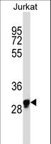 OR1N1 Antibody - OR1N1 Antibody western blot of Jurkat cell line lysates (35 ug/lane). The OR1N1 antibody detected the OR1N1 protein (arrow).