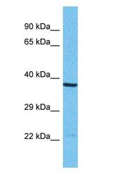 OR1N1 Antibody - OR1N1 antibody Western Blot of HepG2. Antibody dilution: 1 ug/ml.  This image was taken for the unconjugated form of this product. Other forms have not been tested.