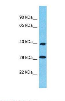 OR1N2 Antibody - Western blot of Human ACHN. OR1N2 antibody dilution 1.0 ug/ml.  This image was taken for the unconjugated form of this product. Other forms have not been tested.