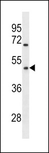 OR1Q1 Antibody - OR1Q1 Antibody western blot of MDA-MB231 cell line lysates (35 ug/lane). The OR1Q1 antibody detected the OR1Q1 protein (arrow).