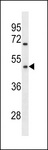 OR1Q1 Antibody - OR1Q1 Antibody western blot of MDA-MB231 cell line lysates (35 ug/lane). The OR1Q1 antibody detected the OR1Q1 protein (arrow).