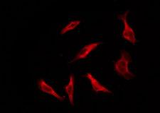 OR1S1+2 Antibody - Staining HT29 cells by IF/ICC. The samples were fixed with PFA and permeabilized in 0.1% Triton X-100, then blocked in 10% serum for 45 min at 25°C. The primary antibody was diluted at 1:200 and incubated with the sample for 1 hour at 37°C. An Alexa Fluor 594 conjugated goat anti-rabbit IgG (H+L) Ab, diluted at 1/600, was used as the secondary antibody.