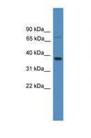 OR1S1 Antibody - OR1S1 antibody Western blot of Fetal Lung lysate. Antibody concentration 1 ug/ml.  This image was taken for the unconjugated form of this product. Other forms have not been tested.