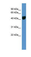 OR1S1 Antibody - OR1S1 antibody Western blot of COLO205 cell lysate.  This image was taken for the unconjugated form of this product. Other forms have not been tested.