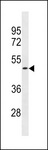 OR1S2 Antibody - OR1S2 Antibody western blot of ZR-75-1 cell line lysates (35 ug/lane). The OR1S2 antibody detected the OR1S2 protein (arrow).