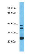 OR2A12 Antibody - OR2A12 antibody Western Blot of 721_B. Antibody dilution: 1 ug/ml.  This image was taken for the unconjugated form of this product. Other forms have not been tested.