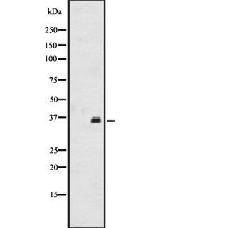 OR2A12 Antibody - Western blot analysis of OR2A12 expression in CEM cells line lysates. The lane on the left is treated with the antigen-specific peptide.