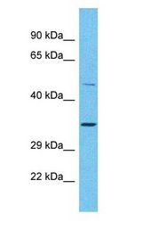 OR2A25 Antibody - OR2A25 antibody Western Blot of Placenta. Antibody dilution: 1 ug/ml.  This image was taken for the unconjugated form of this product. Other forms have not been tested.