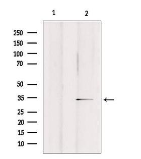 OR2A25 Antibody - Western blot analysis of extracts of rat brain tissue using OR2A25 antibody. Lane 1 was treated with the blocking peptide.