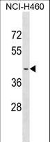 OR2A4 Antibody - OR2A4 Antibody western blot of NCI-H460 cell line lysates (35 ug/lane). The OR2A4 antibody detected the OR2A4 protein (arrow).