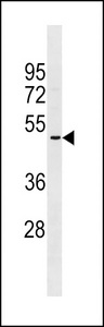 OR2A5 Antibody - OR2A5 Antibody western blot of NCI-H460 cell line lysates (35 ug/lane). The OR2A5 antibody detected the OR2A5 protein (arrow).