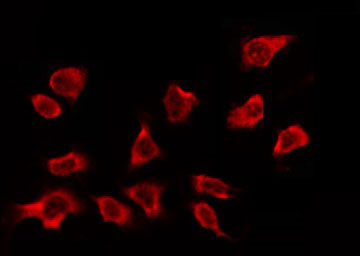 OR2A5+OR2A14 Antibody - Staining HeLa cells by IF/ICC. The samples were fixed with PFA and permeabilized in 0.1% Triton X-100, then blocked in 10% serum for 45 min at 25°C. The primary antibody was diluted at 1:200 and incubated with the sample for 1 hour at 37°C. An Alexa Fluor 594 conjugated goat anti-rabbit IgG (H+L) Ab, diluted at 1/600, was used as the secondary antibody.