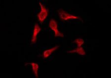 OR2A7 Antibody - Staining HeLa cells by IF/ICC. The samples were fixed with PFA and permeabilized in 0.1% Triton X-100, then blocked in 10% serum for 45 min at 25°C. The primary antibody was diluted at 1:200 and incubated with the sample for 1 hour at 37°C. An Alexa Fluor 594 conjugated goat anti-rabbit IgG (H+L) Ab, diluted at 1/600, was used as the secondary antibody.
