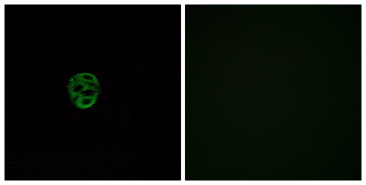OR2AE1 Antibody - Immunofluorescence analysis of A549 cells, using OR2AE1 Antibody. The picture on the right is blocked with the synthesized peptide.