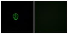 OR2AE1 Antibody - Immunofluorescence analysis of A549 cells, using OR2AE1 Antibody. The picture on the right is blocked with the synthesized peptide.