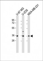 OR2AE1 Antibody - All lanes: Anti-OR2AE1 Antibody (C-term) at 1:1000 dilution Lane 1: U-87 MG whole cell lysate Lane 2: U-2OS whole cell lysate Lane 3: MDA-MB-231 whole cell lysate Lysates/proteins at 20 µg per lane. Secondary Goat Anti-Rabbit IgG, (H+L), Peroxidase conjugated at 1/10000 dilution. Predicted band size: 36 kDa Blocking/Dilution buffer: 5% NFDM/TBST.
