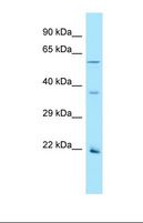 OR2AG1 Antibody - Western blot of Human Hela. OR2AG1 antibody dilution 1.0 ug/ml.  This image was taken for the unconjugated form of this product. Other forms have not been tested.