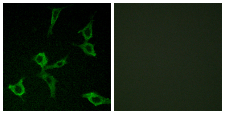 OR2AG1 + OR2AG2 Antibody - Immunofluorescence analysis of LOVO cells, using OR2AG1/2AG2 Antibody. The picture on the right is blocked with the synthesized peptide.