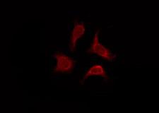 OR2AP1 Antibody - Staining HeLa cells by IF/ICC. The samples were fixed with PFA and permeabilized in 0.1% Triton X-100, then blocked in 10% serum for 45 min at 25°C. The primary antibody was diluted at 1:200 and incubated with the sample for 1 hour at 37°C. An Alexa Fluor 594 conjugated goat anti-rabbit IgG (H+L) Ab, diluted at 1/600, was used as the secondary antibody.