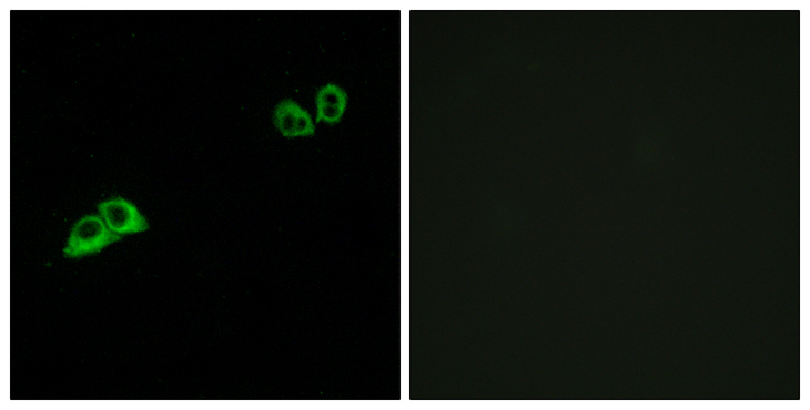 OR2AT4 Antibody - Immunofluorescence analysis of MCF7 cells, using OR2AT4 Antibody. The picture on the right is blocked with the synthesized peptide.