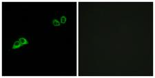 OR2AT4 Antibody - Immunofluorescence analysis of MCF7 cells, using OR2AT4 Antibody. The picture on the right is blocked with the synthesized peptide.