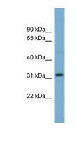 OR2AT4 Antibody - OR2AT4 antibody Western blot of OVCAR-3 cell lysate. This image was taken for the unconjugated form of this product. Other forms have not been tested.
