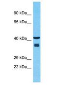 OR2B11 Antibody - OR2B11 antibody Western Blot of Fetal Liver. Antibody dilution: 1 ug/ml.  This image was taken for the unconjugated form of this product. Other forms have not been tested.