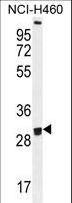 OR2B11 Antibody - OR2B11 Antibody western blot of NCI-H460 cell line lysates (35 ug/lane). The OR2B11 antibody detected the OR2B11 protein (arrow).