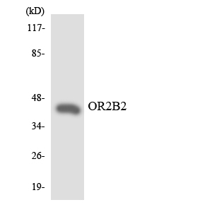 OR2B2 Antibody - Western blot analysis of the lysates from Jurkat cells using OR2B2 antibody.