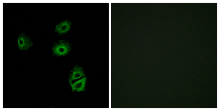 OR2B2 Antibody - Immunofluorescence analysis of A549 cells, using OR2B2 Antibody. The picture on the right is blocked with the synthesized peptide.