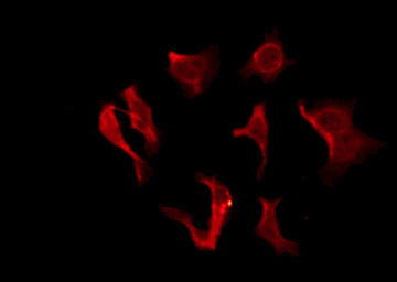 OR2B2 Antibody - Staining HeLa cells by IF/ICC. The samples were fixed with PFA and permeabilized in 0.1% Triton X-100, then blocked in 10% serum for 45 min at 25°C. The primary antibody was diluted at 1:200 and incubated with the sample for 1 hour at 37°C. An Alexa Fluor 594 conjugated goat anti-rabbit IgG (H+L) Ab, diluted at 1/600, was used as the secondary antibody.