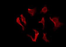 OR2B2 Antibody - Staining HeLa cells by IF/ICC. The samples were fixed with PFA and permeabilized in 0.1% Triton X-100, then blocked in 10% serum for 45 min at 25°C. The primary antibody was diluted at 1:200 and incubated with the sample for 1 hour at 37°C. An Alexa Fluor 594 conjugated goat anti-rabbit IgG (H+L) Ab, diluted at 1/600, was used as the secondary antibody.