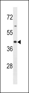 OR2B6 Antibody - OR2B6 Antibody western blot of MDA-MB453 cell line lysates (35 ug/lane). The OR2B6 antibody detected the OR2B6 protein (arrow).