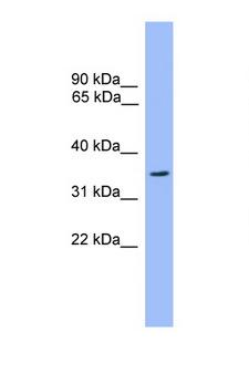 OR2C3 Antibody - OR2C3 antibody Western blot of 721E1 Cell lysate. Antibody concentration 1 ug/ml.  This image was taken for the unconjugated form of this product. Other forms have not been tested.