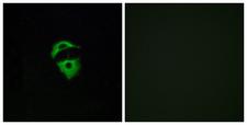 OR2D2 Antibody - Immunofluorescence analysis of A549 cells, using OR2D2 Antibody. The picture on the right is blocked with the synthesized peptide.
