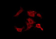 OR2D3 Antibody - Staining HeLa cells by IF/ICC. The samples were fixed with PFA and permeabilized in 0.1% Triton X-100, then blocked in 10% serum for 45 min at 25°C. The primary antibody was diluted at 1:200 and incubated with the sample for 1 hour at 37°C. An Alexa Fluor 594 conjugated goat anti-rabbit IgG (H+L) Ab, diluted at 1/600, was used as the secondary antibody.