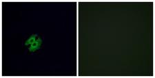 OR2G2 Antibody - Immunofluorescence analysis of A549 cells, using OR2G2 Antibody. The picture on the right is blocked with the synthesized peptide.