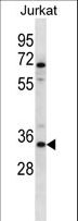 OR2G3 Antibody - OR2G3 Antibody western blot of Jurkat cell line lysates (35 ug/lane). The OR2G3 antibody detected the OR2G3 protein (arrow).