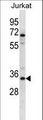 OR2G3 Antibody - OR2G3 Antibody western blot of Jurkat cell line lysates (35 ug/lane). The OR2G3 antibody detected the OR2G3 protein (arrow).