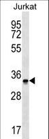 OR2G6 Antibody - OR2G6 Antibody western blot of Jurkat cell line lysates (35 ug/lane). The OR2G6 antibody detected the OR2G6 protein (arrow).