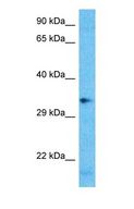 OR2H1 Antibody - Western blot of OR2H1 Antibody with human HT1080 Whole Cell lysate.  This image was taken for the unconjugated form of this product. Other forms have not been tested.