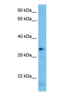 OR2H1 Antibody - Western blot of OR2H1 Antibody with human HT1080 Whole Cell lysate.  This image was taken for the unconjugated form of this product. Other forms have not been tested.