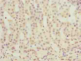 OR2H1 Antibody - Immunohistochemistry of paraffin-embedded human adrenal gland tissue using antibody at dilution of 1:100.