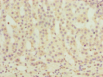 OR2H1 Antibody - Immunohistochemistry of paraffin-embedded human adrenal gland tissue using OR2H1 Antibody at dilution of 1:100