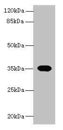 OR2H1 Antibody - Western blot All lanes: OR2H1 antibody at 0.5µg/ml + Mouse liver tissue Secondary Goat polyclonal to rabbit IgG at 1/10000 dilution Predicted band size: 35 kDa Observed band size: 35 kDa
