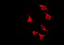 OR2H3 / OR2H2 Antibody - Staining HeLa cells by IF/ICC. The samples were fixed with PFA and permeabilized in 0.1% Triton X-100, then blocked in 10% serum for 45 min at 25°C. The primary antibody was diluted at 1:200 and incubated with the sample for 1 hour at 37°C. An Alexa Fluor 594 conjugated goat anti-rabbit IgG (H+L) Ab, diluted at 1/600, was used as the secondary antibody.