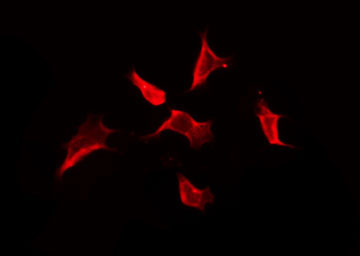 OR2I1P Antibody - Staining HuvEc cells by IF/ICC. The samples were fixed with PFA and permeabilized in 0.1% Triton X-100, then blocked in 10% serum for 45 min at 25°C. The primary antibody was diluted at 1:200 and incubated with the sample for 1 hour at 37°C. An Alexa Fluor 594 conjugated goat anti-rabbit IgG (H+L) Ab, diluted at 1/600, was used as the secondary antibody.