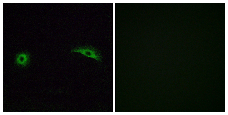 OR2J2 Antibody - Immunofluorescence analysis of A549 cells, using OR2J2 Antibody. The picture on the right is blocked with the synthesized peptide.