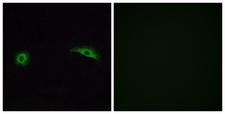 OR2J2 Antibody - Immunofluorescence analysis of A549 cells, using OR2J2 Antibody. The picture on the right is blocked with the synthesized peptide.