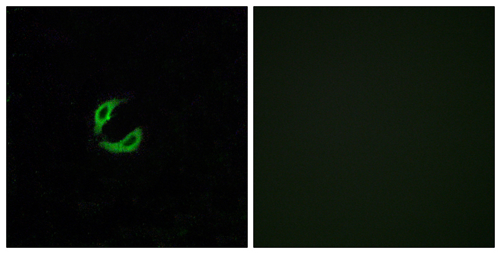 OR2K2 Antibody - Immunofluorescence analysis of A549 cells, using OR2K2 Antibody. The picture on the right is blocked with the synthesized peptide.
